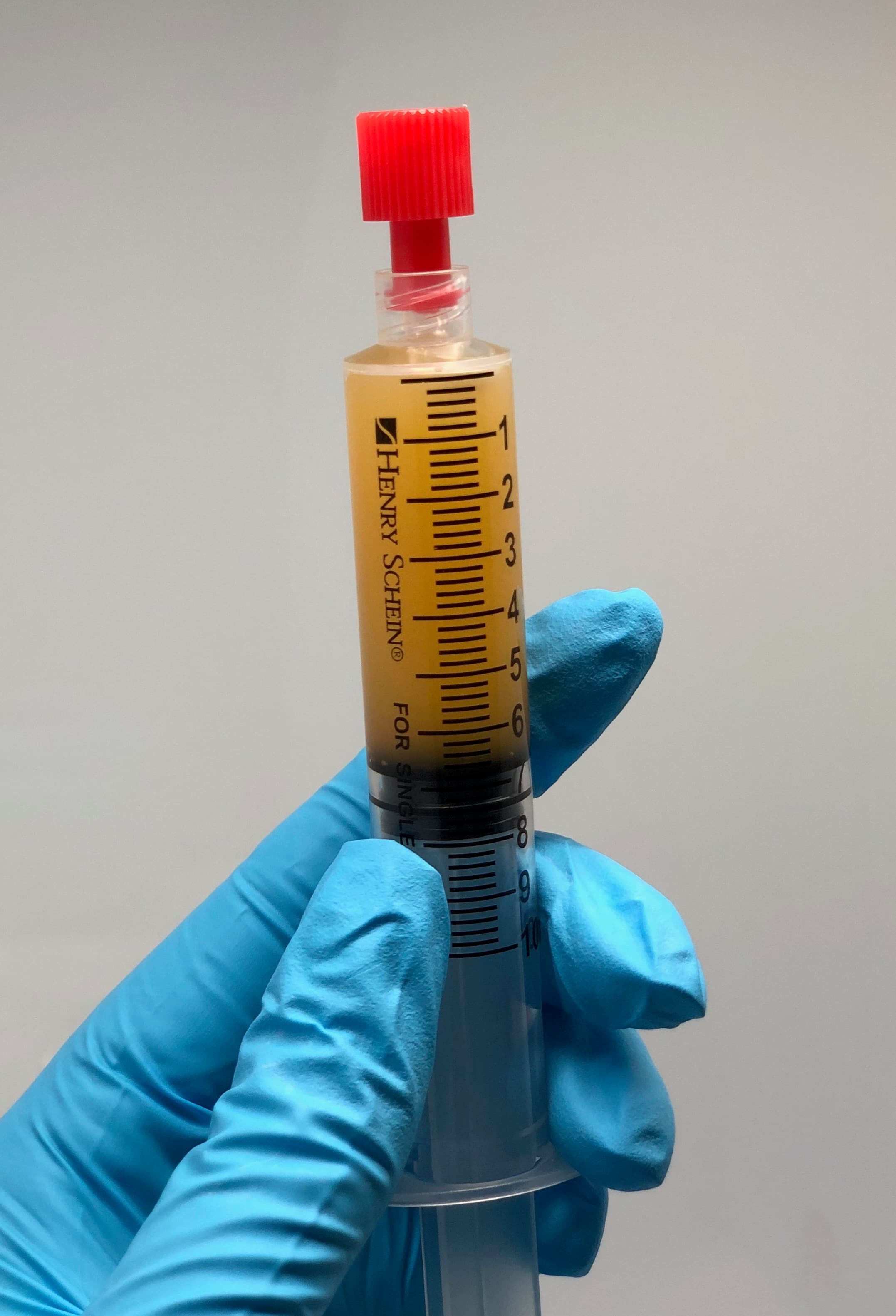 A syringe of concentrated platelet rich growth factors